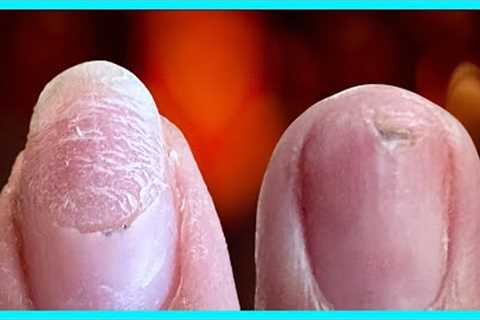 🛑STOP DAMAGING Your Natural Nails! TRY My Proven Technique